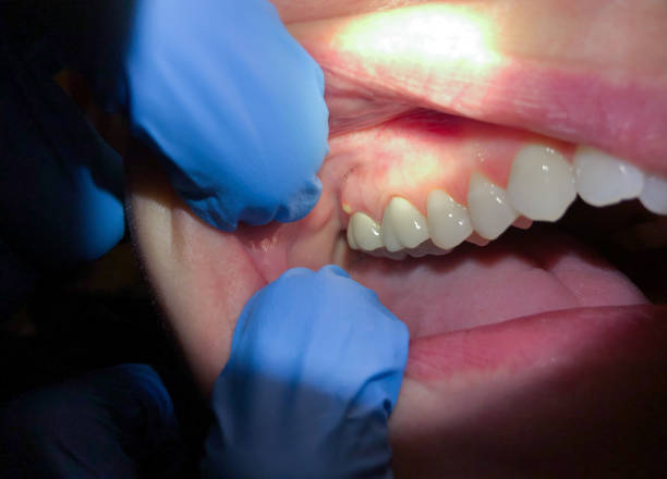 Best Urgent Tooth Repair  in Ebensburg, PA
